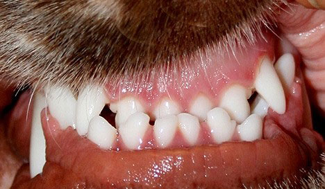 Underbitt med avstand mellom tennene i overkjeven og tennene i underkjeven